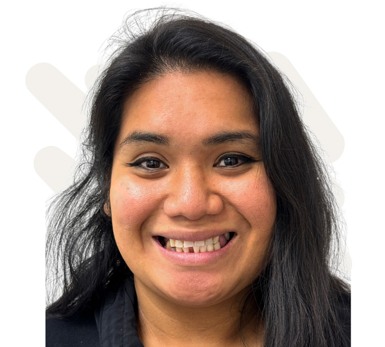 Ivoga Before Dental Implant