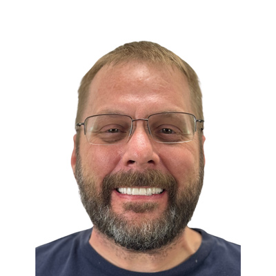 James After Dental Implant