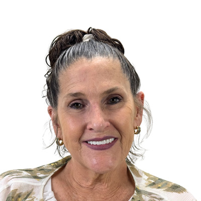 Jamie P After Dental Implant