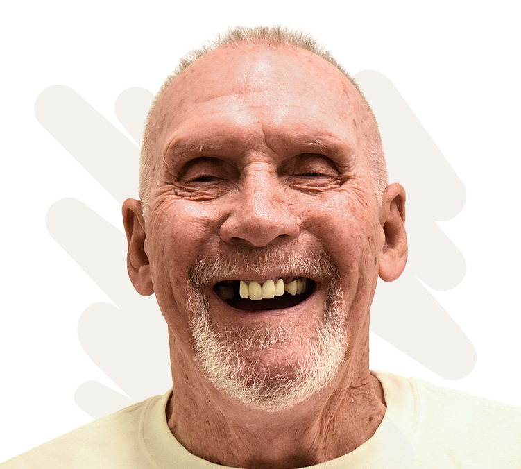 Reed Before Dental Implant