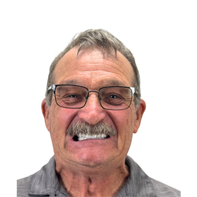 Rodney After Dental Implant