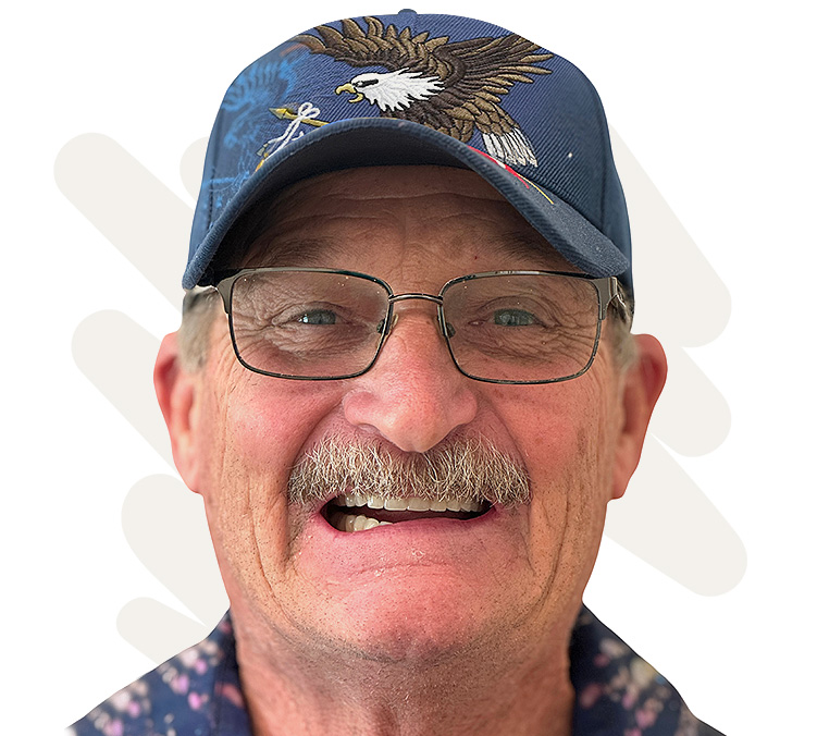 Rodney Before Dental Implant