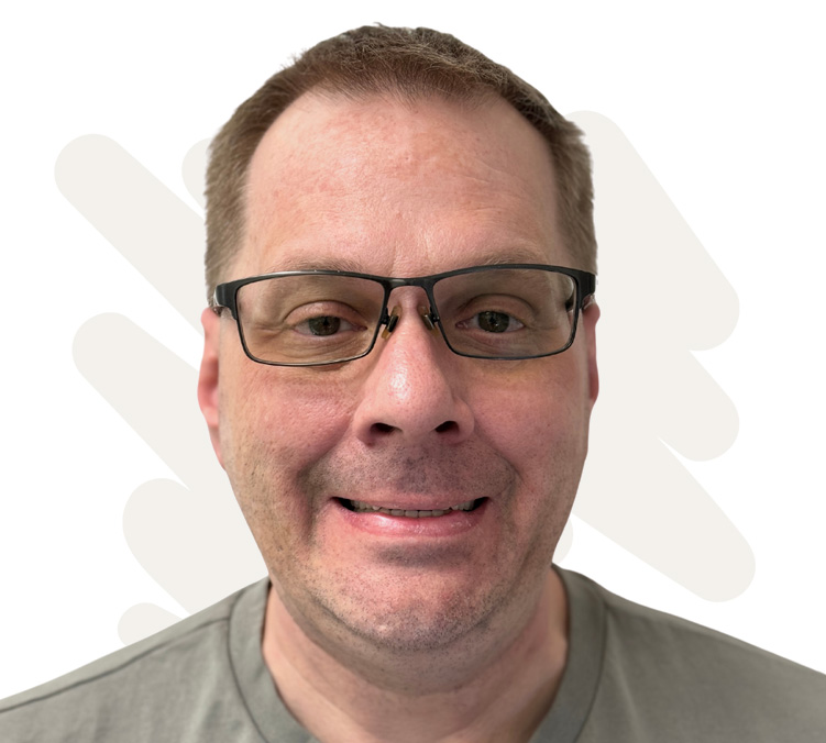 James Before Dental Implant