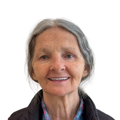 Maria After Dental Implant